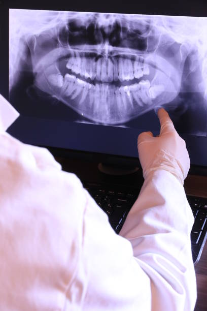 Best Weekend Emergency Dentist in Fredonia, NY