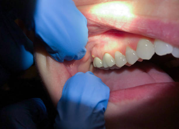 Best Mobile Emergency Dentist in Fredonia, NY