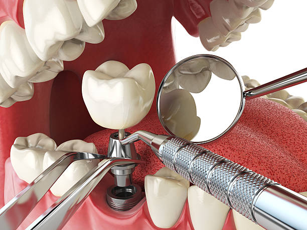 Best Weekend Emergency Dentist in Fredonia, NY