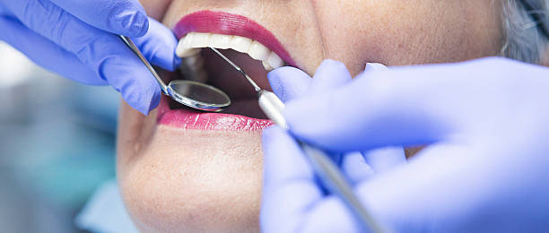 Best Pediatric Emergency Dentist in Fredonia, NY